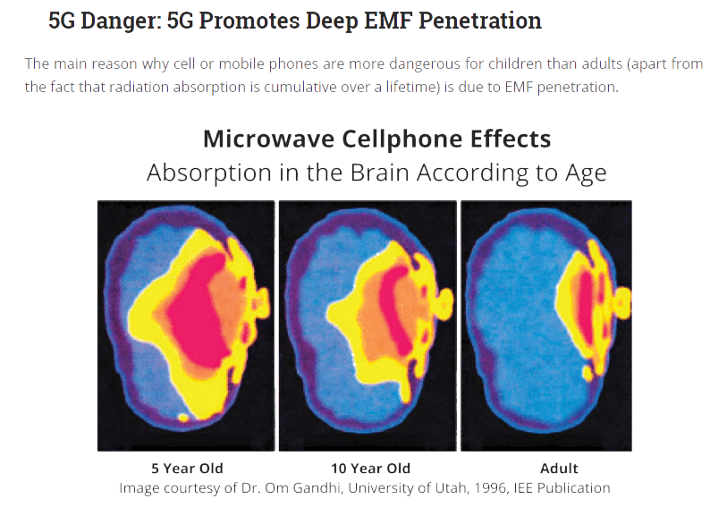 emf brain